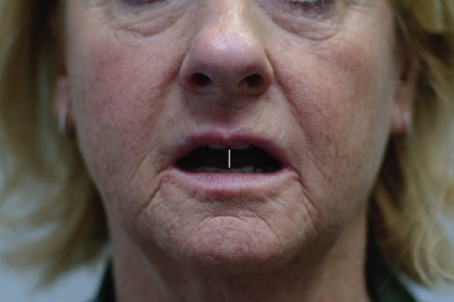 Facial photo of senior female citizen.