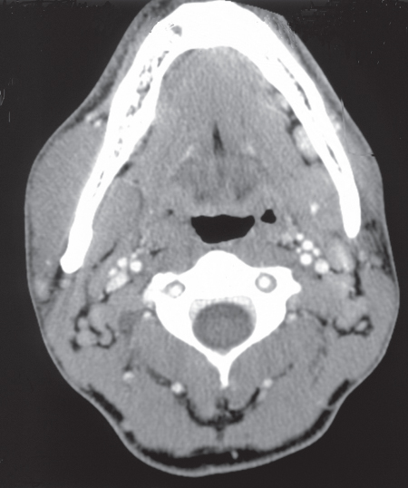 Facial image of patient.