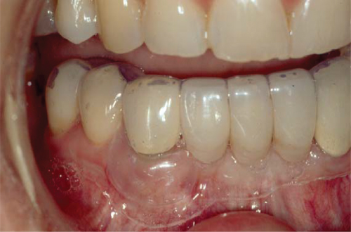 Photo showing Operating microscope and enhanced light facilitates careful examination of teeth in the pain region.