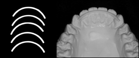 Assessing the feasibility of yttria-stabilized zirconia in novel ...