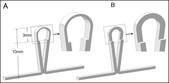 Innovative design of closing loops producing an optimal force system ...