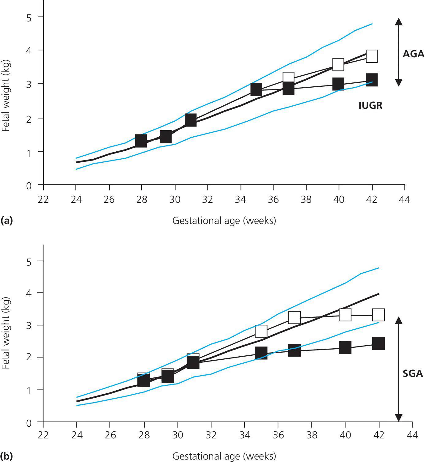 2 Line graphs of fetal weight over gestational age depicting examples of children with normal birth weights at term and IUGR (a) and examples of fetuses with intrauterine growth retardation ending up AGA and SGA (b).