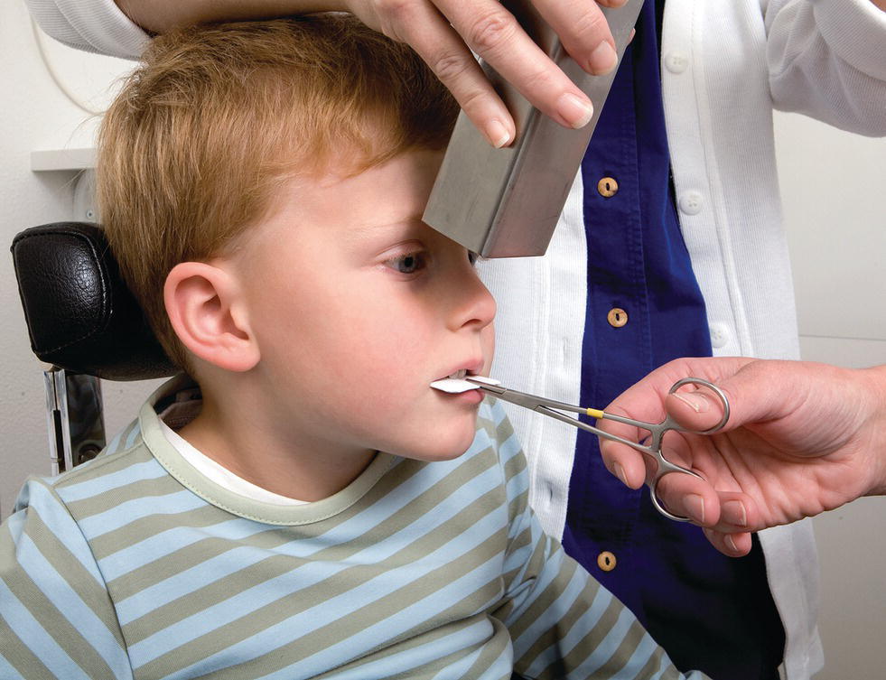 Photo of a child with image receptor on his mouth placed by a hand using a needle holder, and X-ray beam orientated perpendicular to long axis of the front teeth in two identical halves.