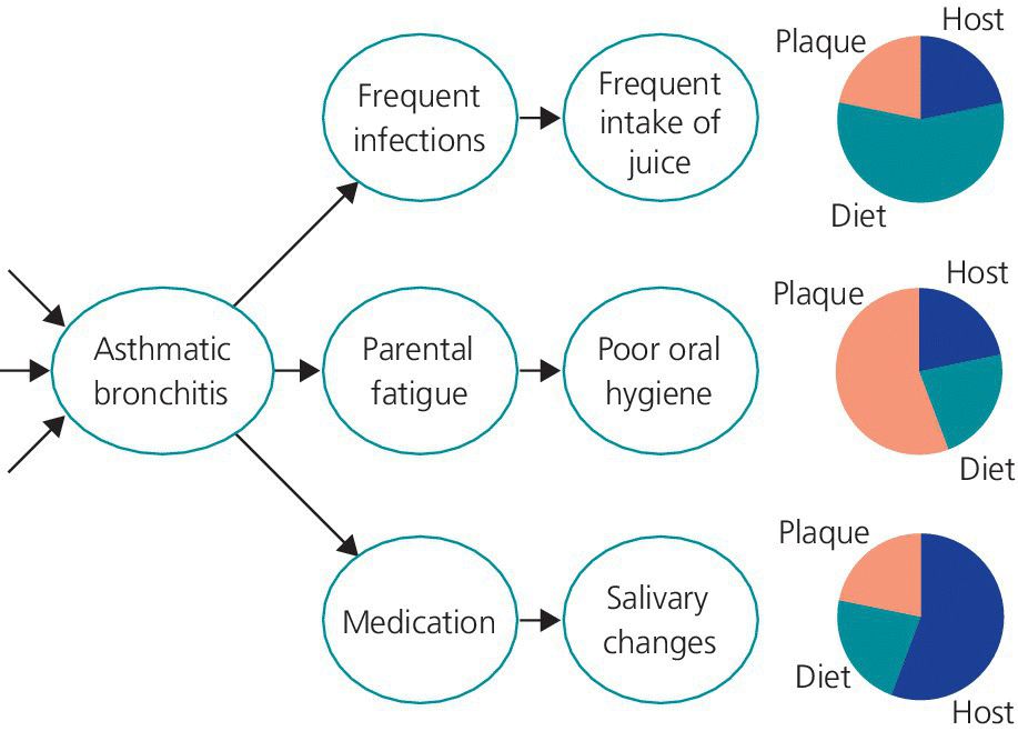 Flow diagram illustrating asthmatic bronchitis and its factors relating to living conditions, genetic background, etc. (left), and pie charts indicating the component causes being influenced (right).