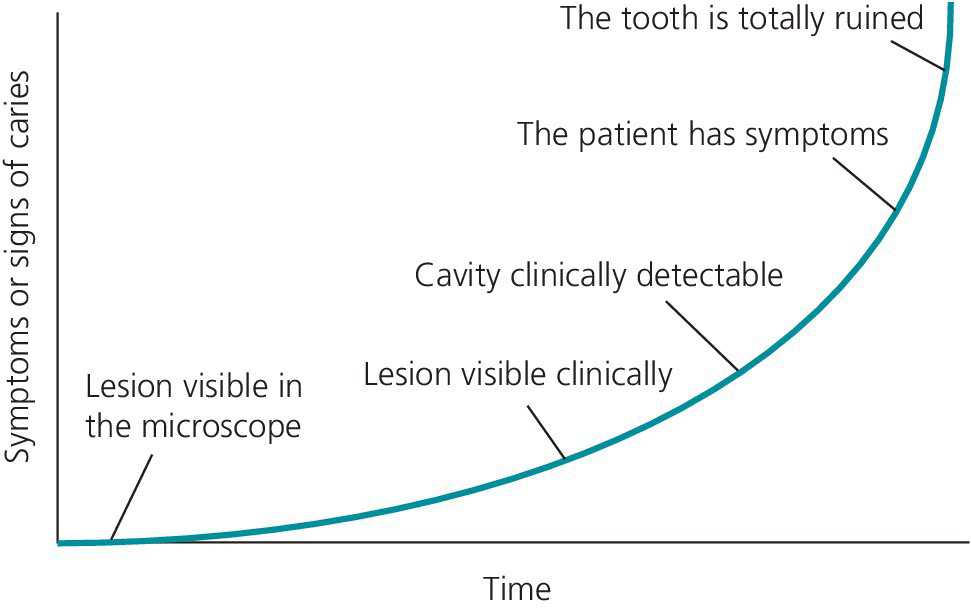 Graph displaying an ascending curve, illustrating the time-dependent development of a lesion from a subclinical level to increasing destruction of dental hard tissues.