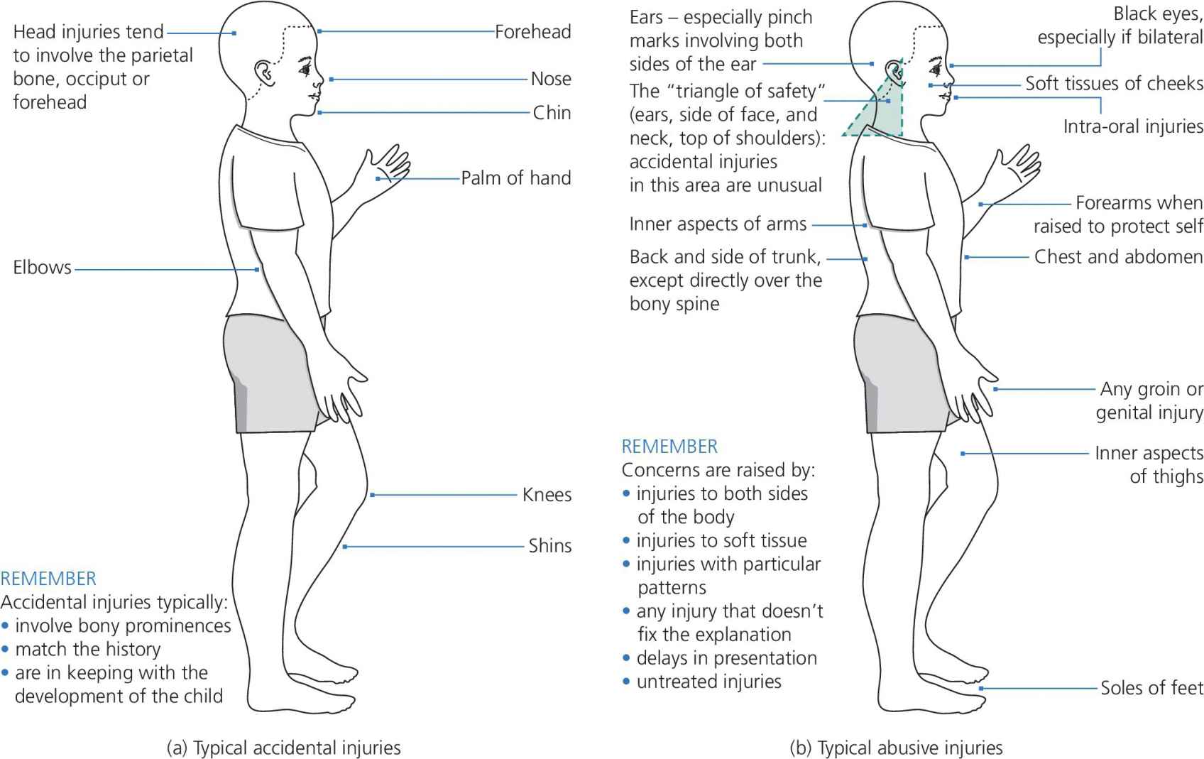 Two illustrations of a child with labeled areas of the body that can be subject to accidental injuries (left) and non-accidental injuries (right).