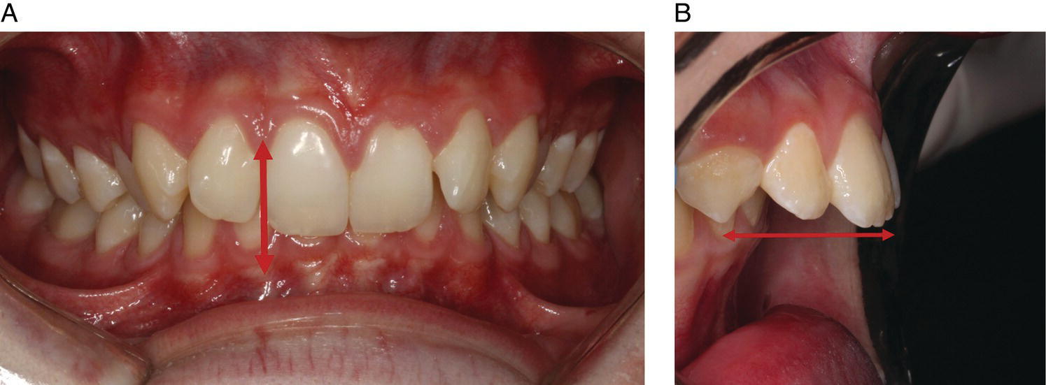 Orthodontic Assessment And Treatment Planning Strategies | Pocket Dentistry