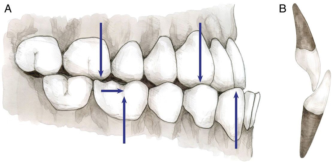 Orthodontic Assessment And Treatment Planning Strategies | Pocket Dentistry