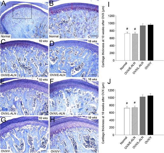 Early Intra-articular Injection Of Alendronate Reduces Cartilage ...