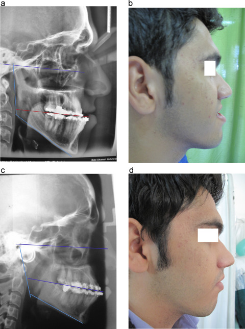 gr3.jpg | Pocket Dentistry