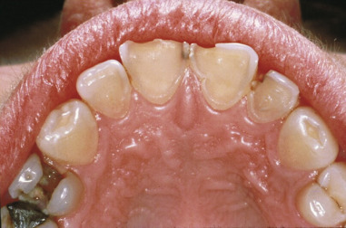 Gastrointestinal Disease | Pocket Dentistry