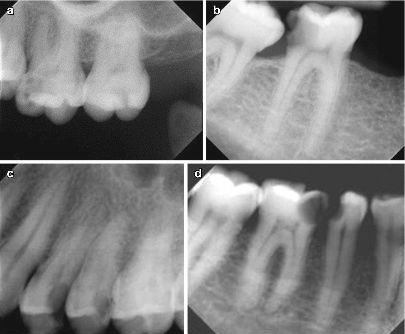 Diagnosis And Treatment Planning | Pocket Dentistry