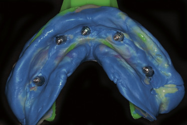 Rg3 Teeth gr3.jpg | Pocket Dentistry