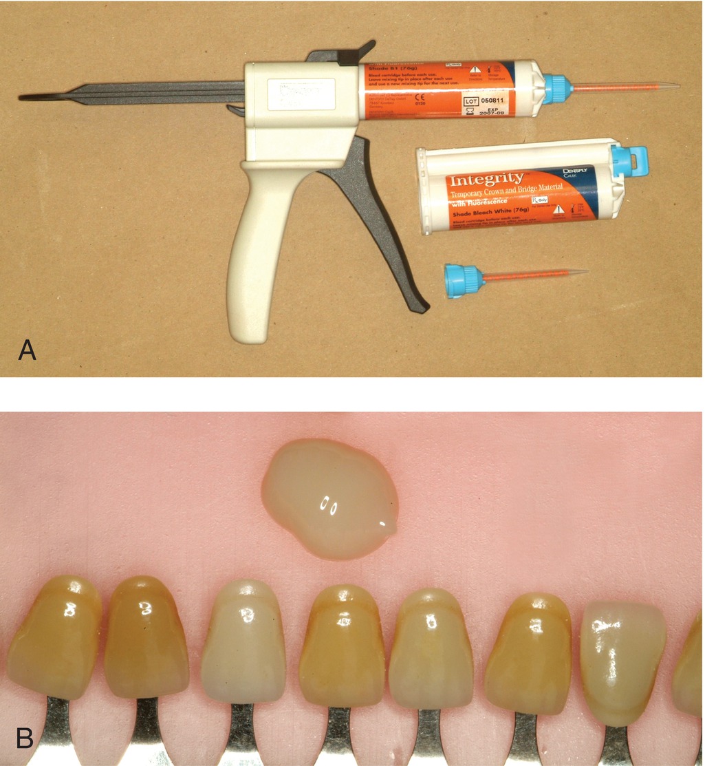 Temporary Crowns | Pocket Dentistry