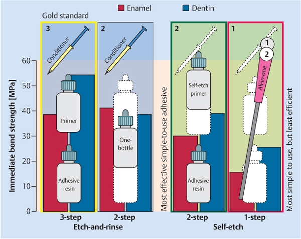 Adhesion: 14 Basics In Adhesion Technology | Pocket Dentistry