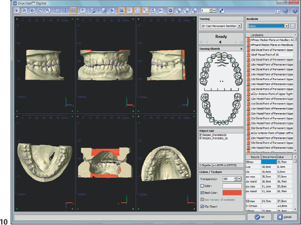 Diagnosis And Treatment Planning | Pocket Dentistry