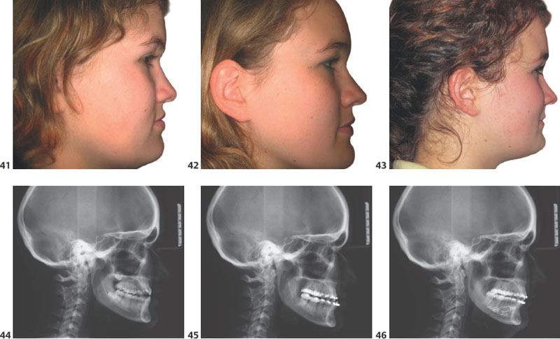 Diagnosis And Treatment Planning | Pocket Dentistry