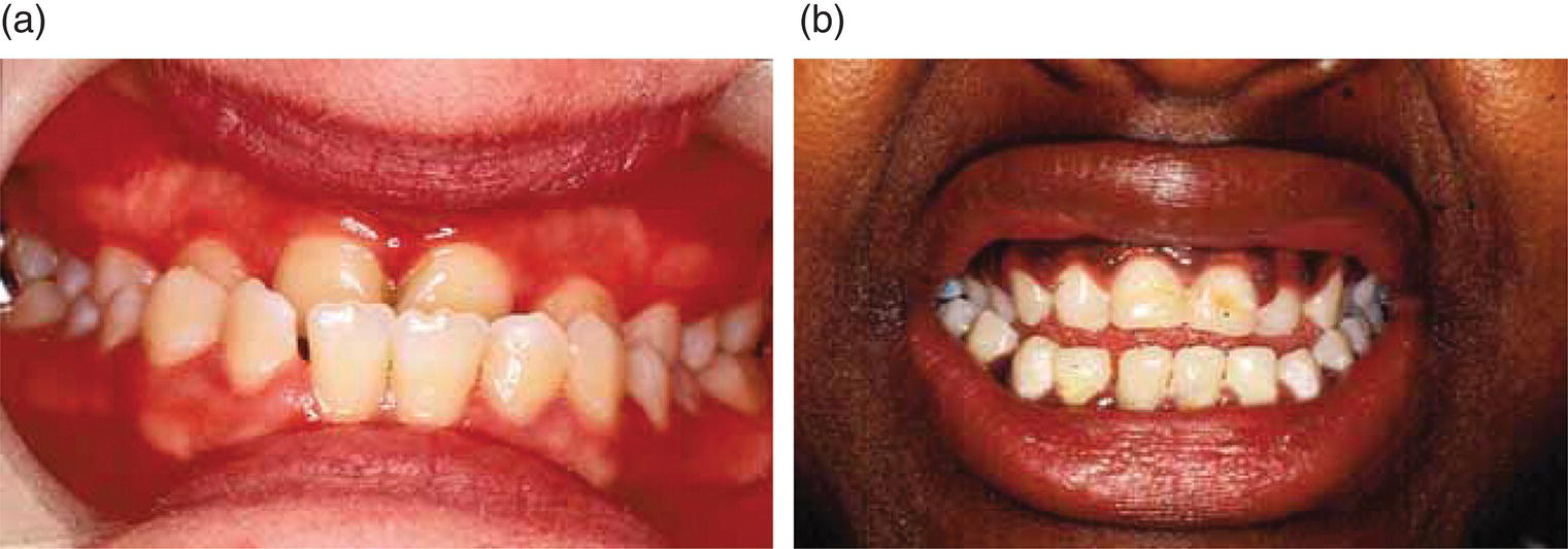 Oral And Dental Anatomy | Pocket Dentistry