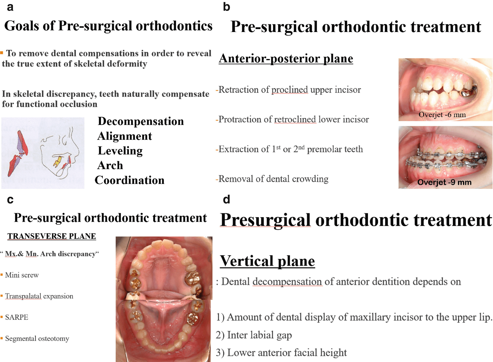 Application Of Surgery-First Orthognathic Surgery In Patients With ...