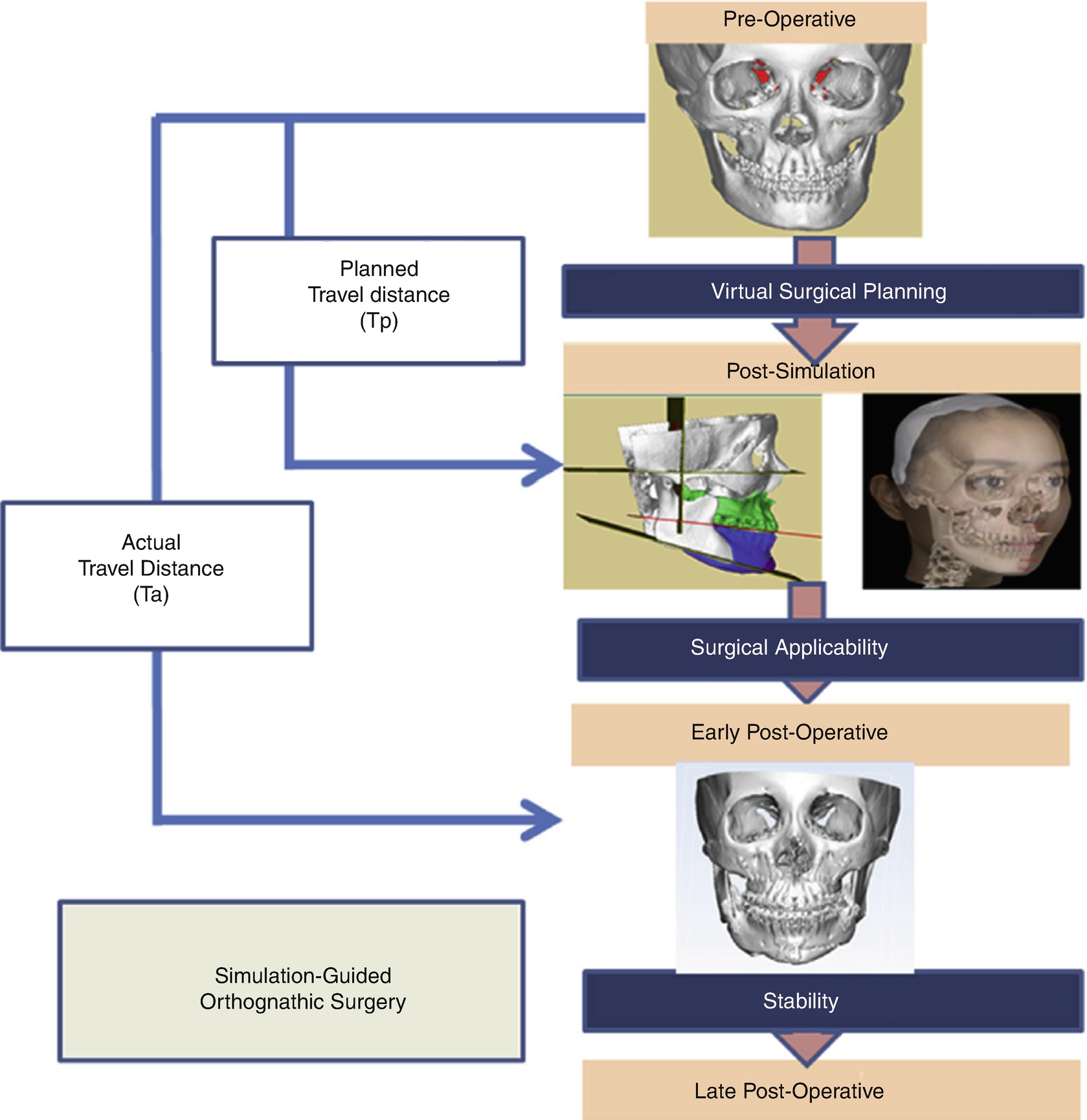 Surgical Planning And Three-Dimensional Simulation In Orthognathic ...