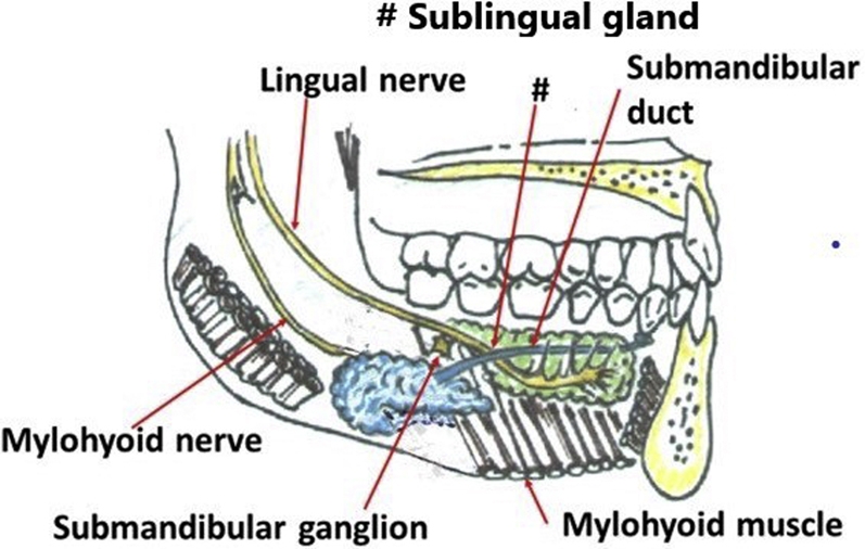 Excision Of Sublingual Gland | Pocket Dentistry