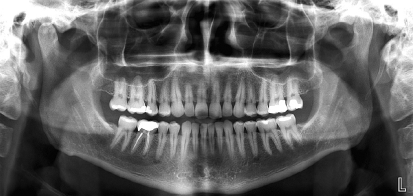 Fundamentals Of Radiographic Interpretation For The Dentist | Pocket ...