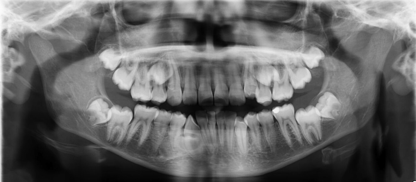 Imaging In Oral And Maxillofacial Surgery | Pocket Dentistry