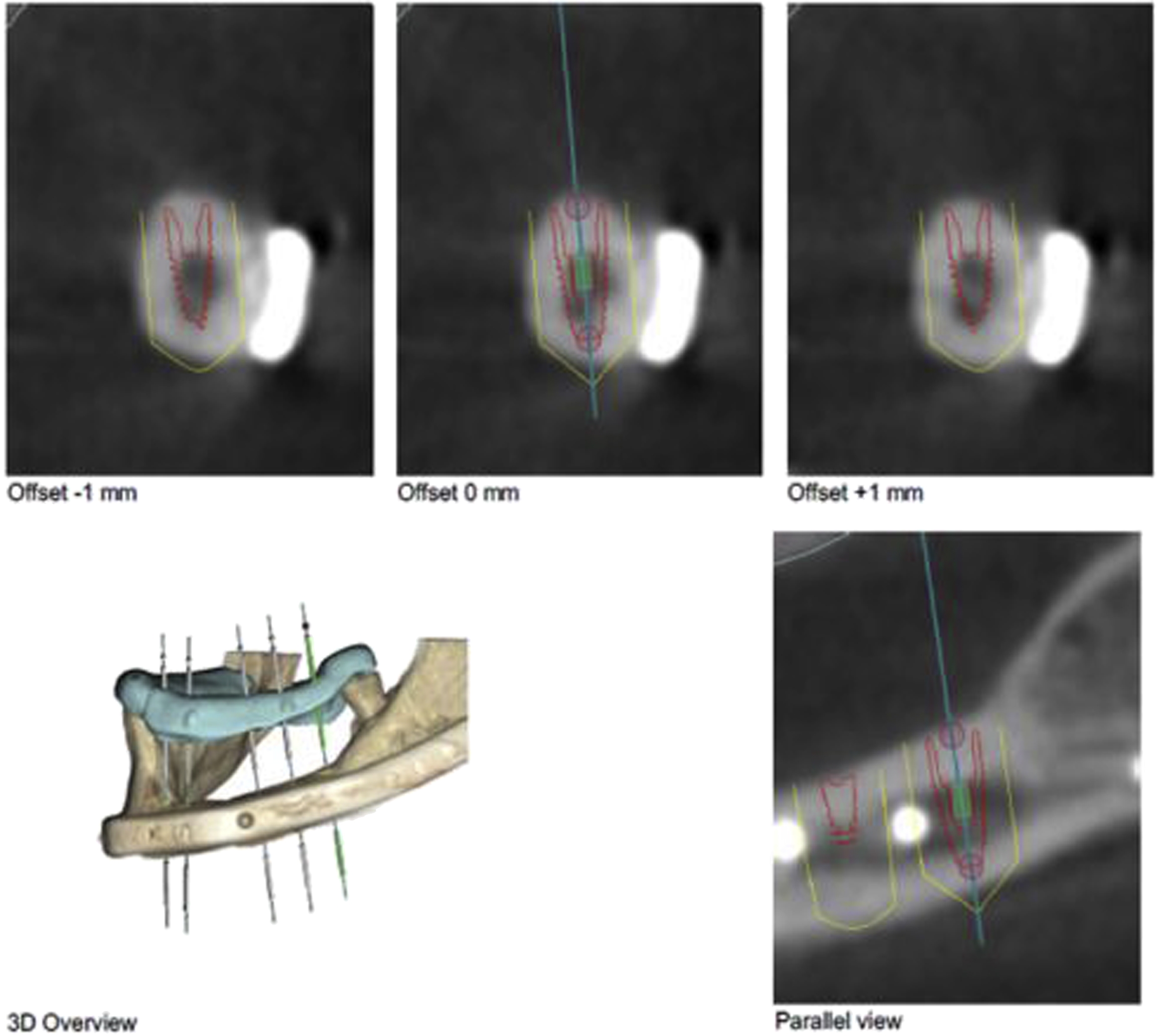 Imaging In Oral And Maxillofacial Surgery | Pocket Dentistry