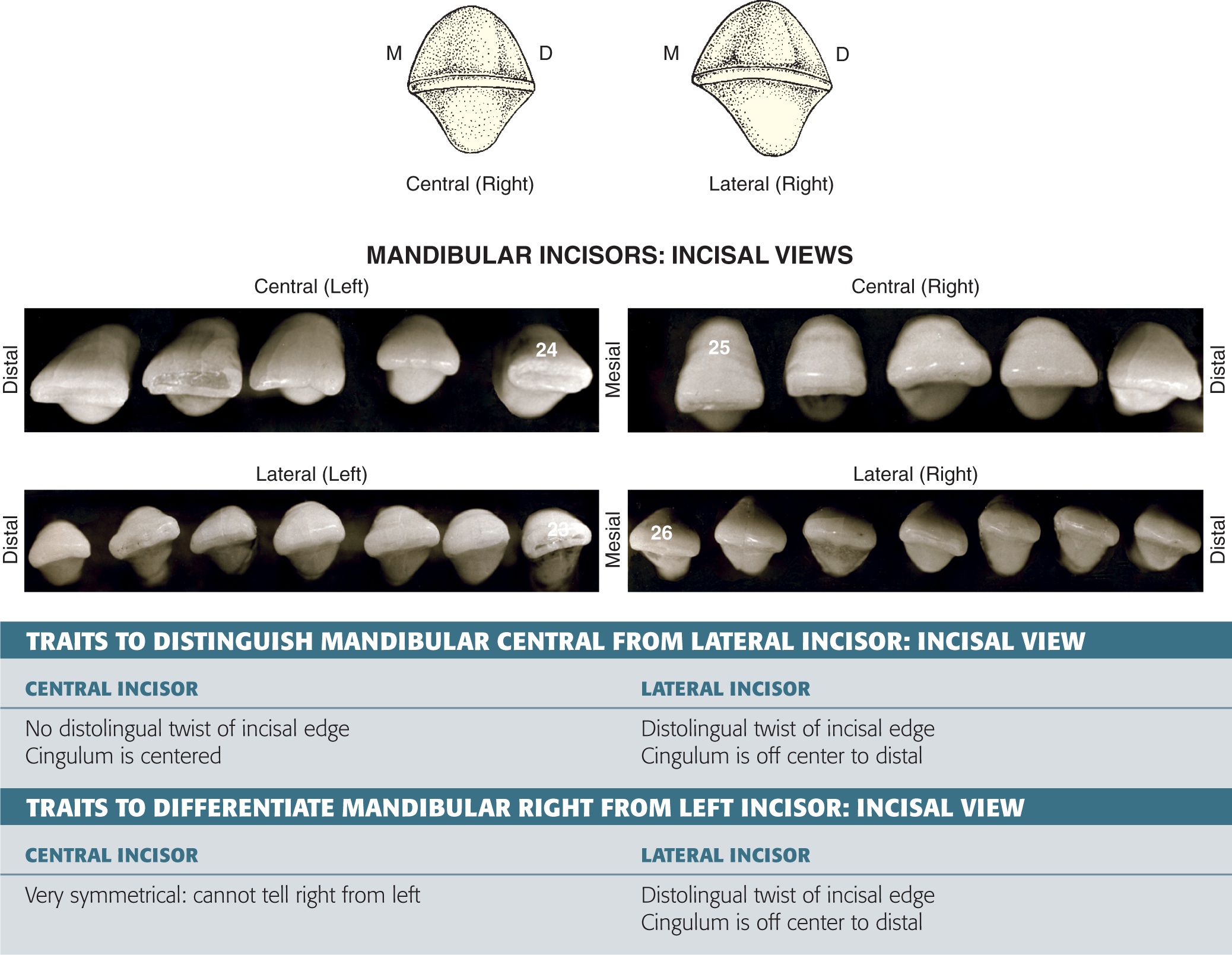 Arch Traits That Differentiate Mandibular From Maxillary Incisors ...