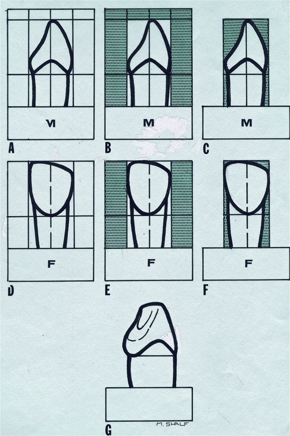 Carving Teeth Pocket Dentistry