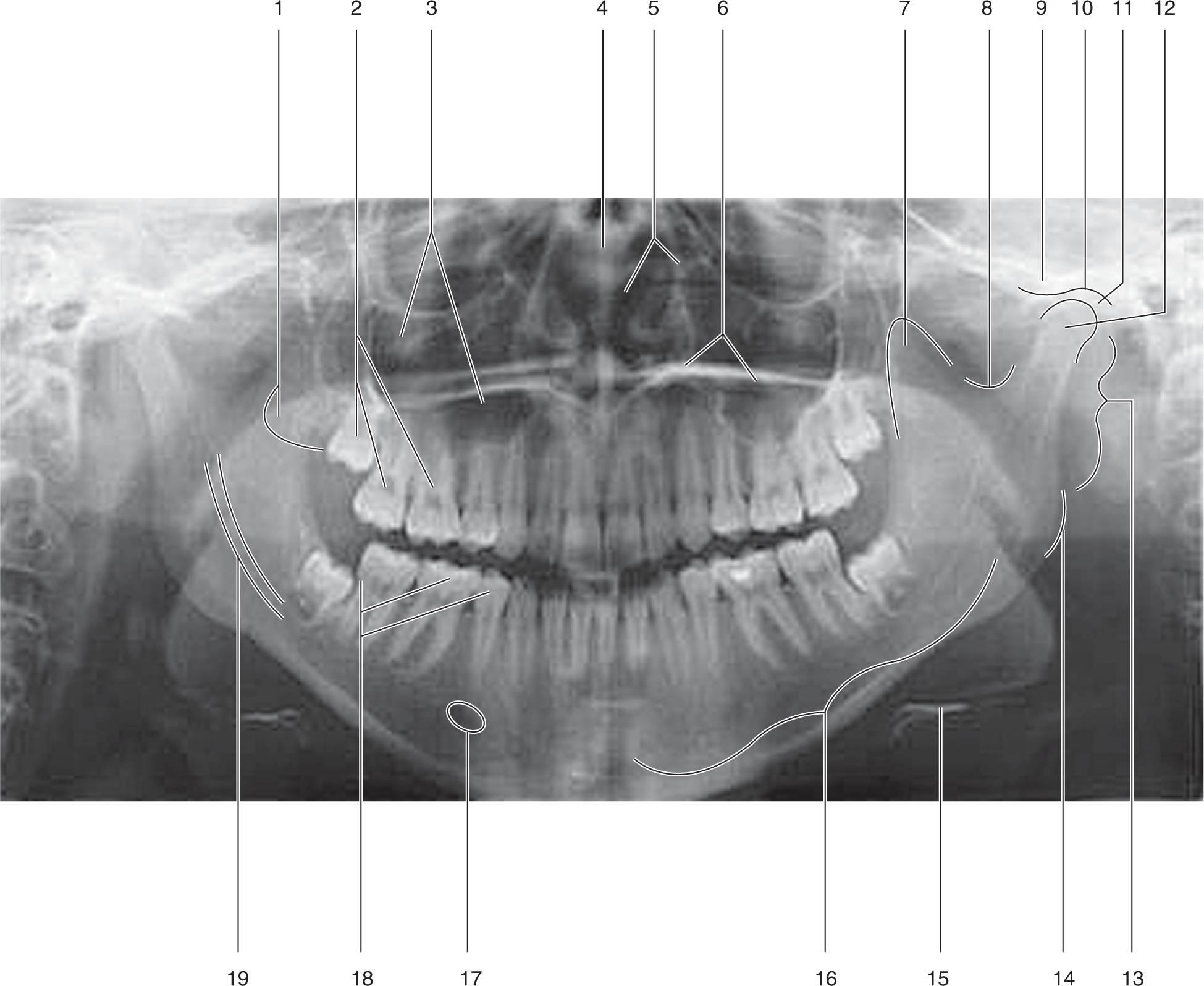 Structures Visible On A Panoramic Radiograph | Pocket Dentistry