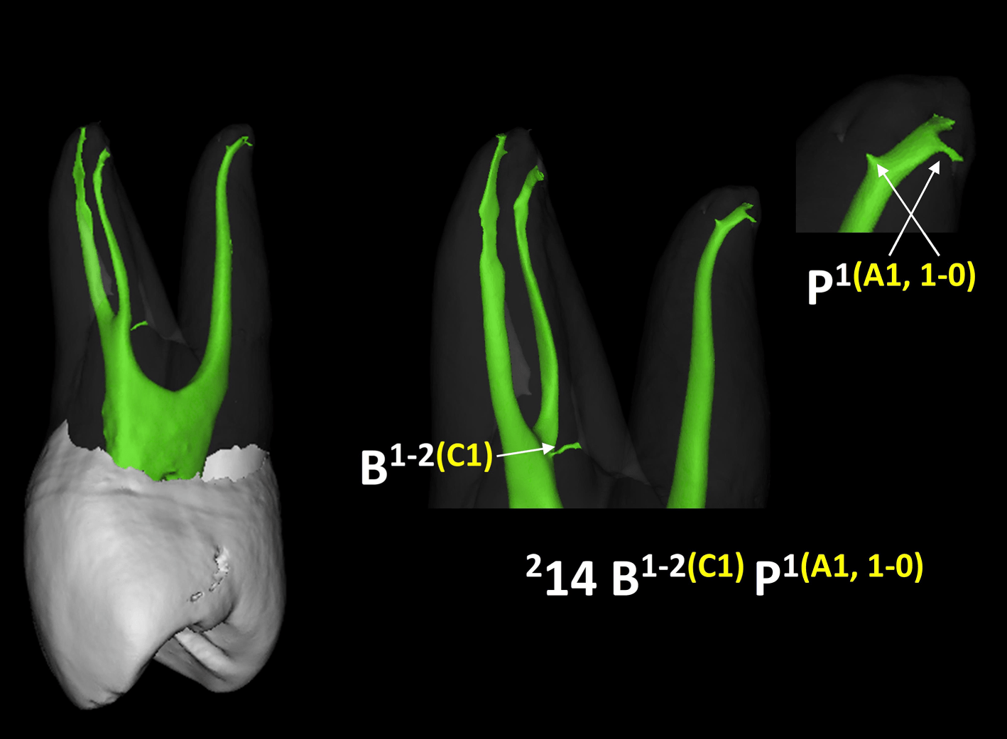 Tooth, Root, And Canal Anatomy | Pocket Dentistry