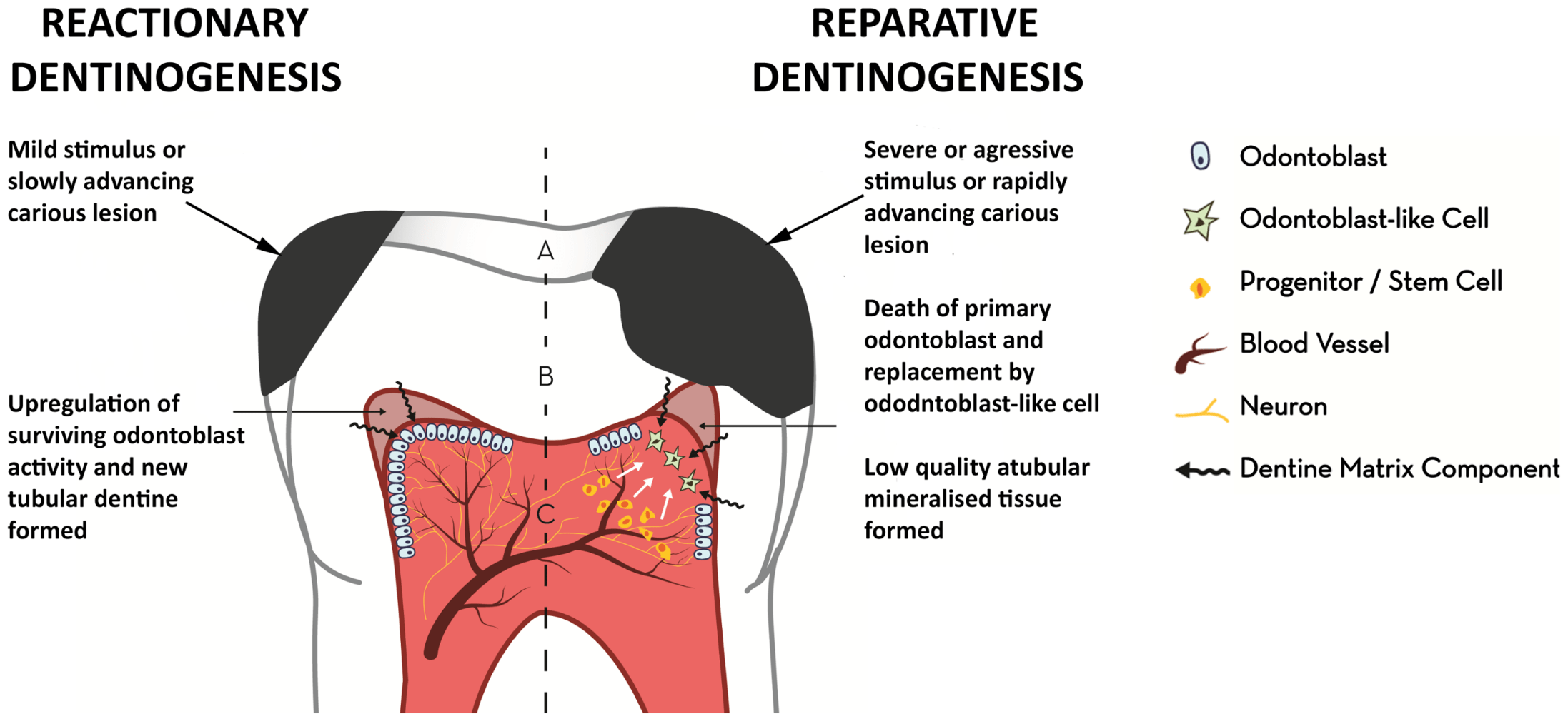 The Bioactive Properties Of Dentine And Molecular Advances In Pulp Regeneration | Pocket Dentistry