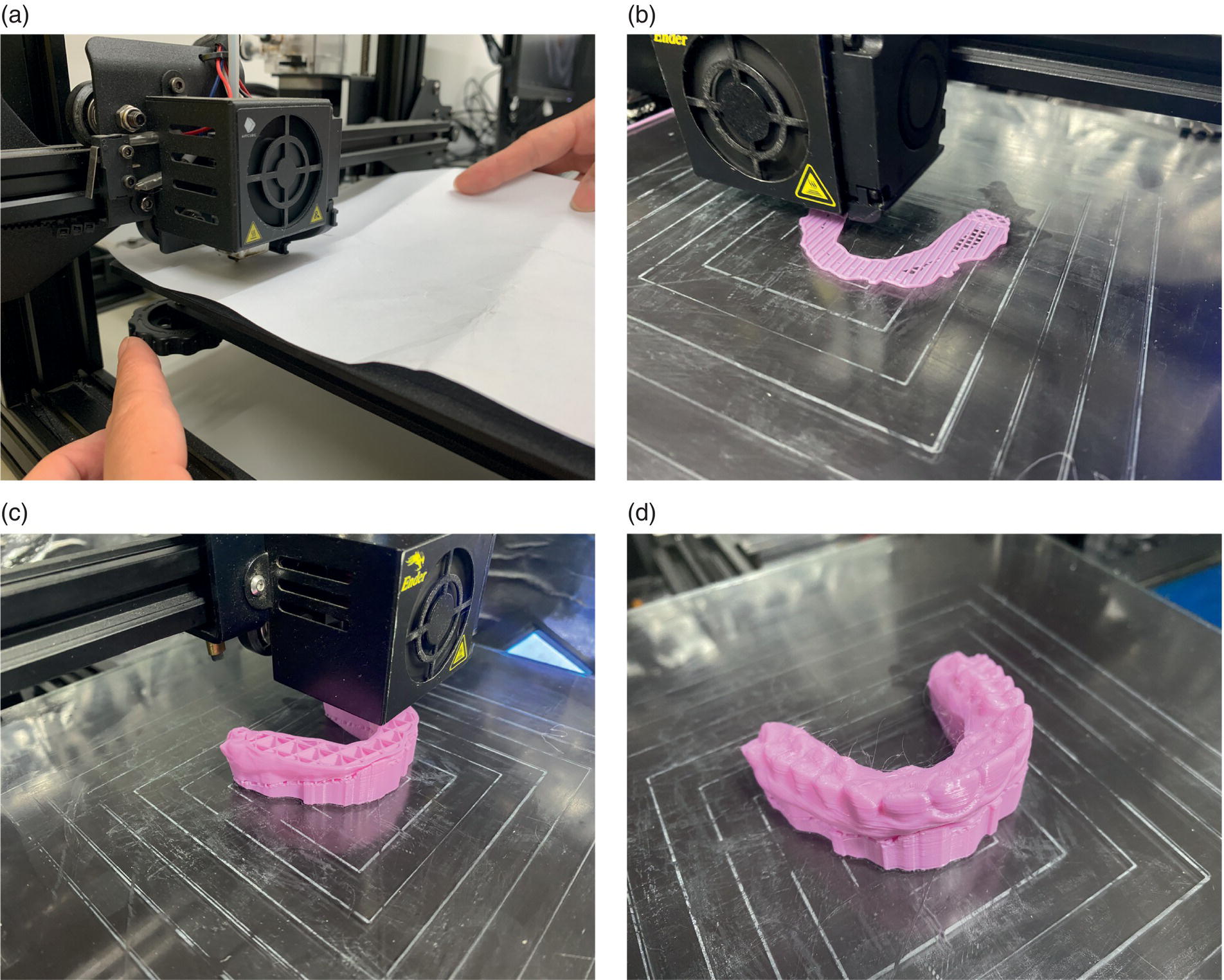 Computer‐Aided Manufacturing (CAM) | Pocket Dentistry