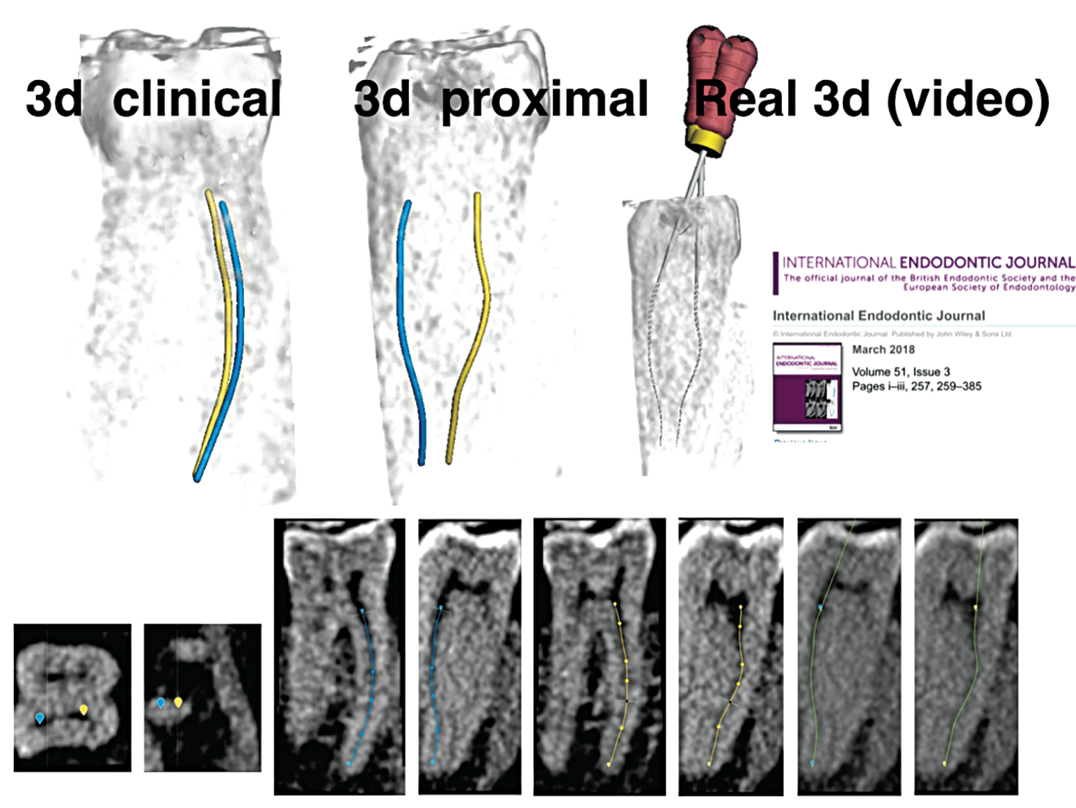 Computed Tomography Imaging Devices And Techniques | Pocket Dentistry