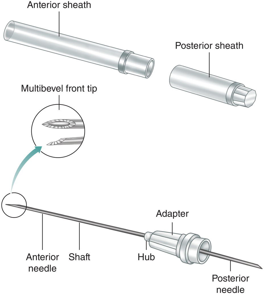 A schematic diagram of the parts of a disposable double-tip needle shows an anterior sheath, posterior sheath, multibevel front tip, anterior needle, shaft, hub, adapter, and posterior needle.