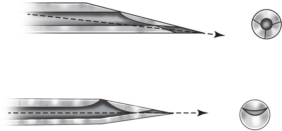 Two diagrams of needles. The upper diagram shows the tip of nondeflecting needles. The lower diagram shows the tip of conventional needles.