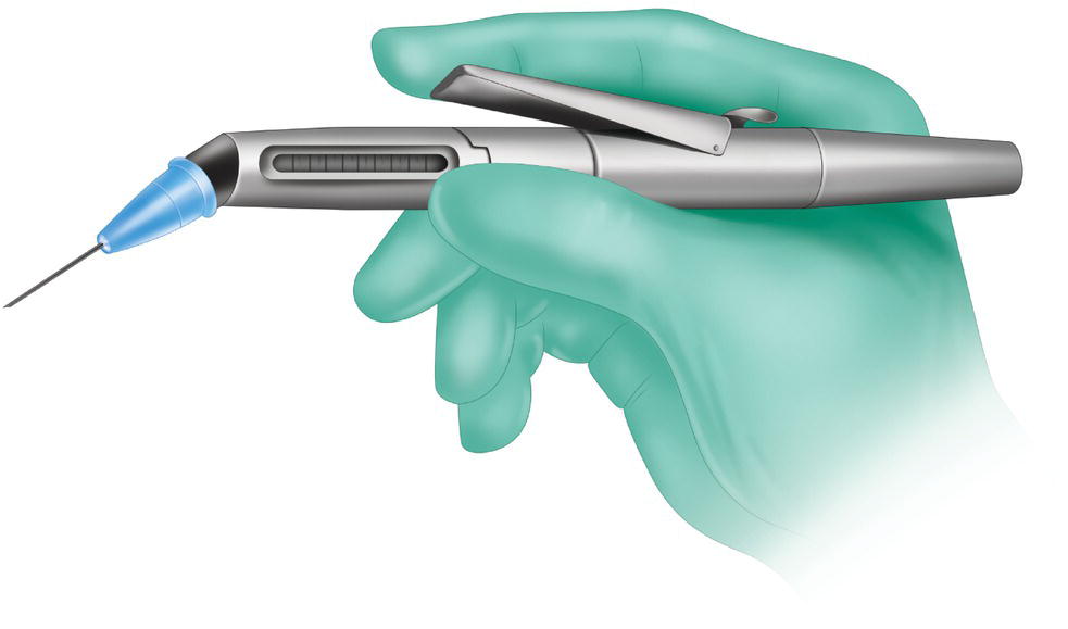 An illustration of a hand holding a high-pressure pen-type syringe.