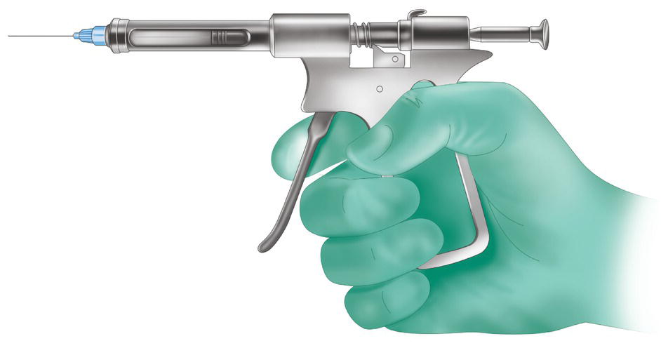 An illustration of a hand holding a high-pressure pistol-type syringe.
