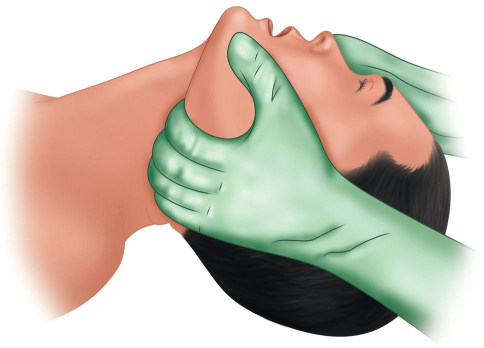 An illustration of applying a thrust in the lower jaw to open the airways.