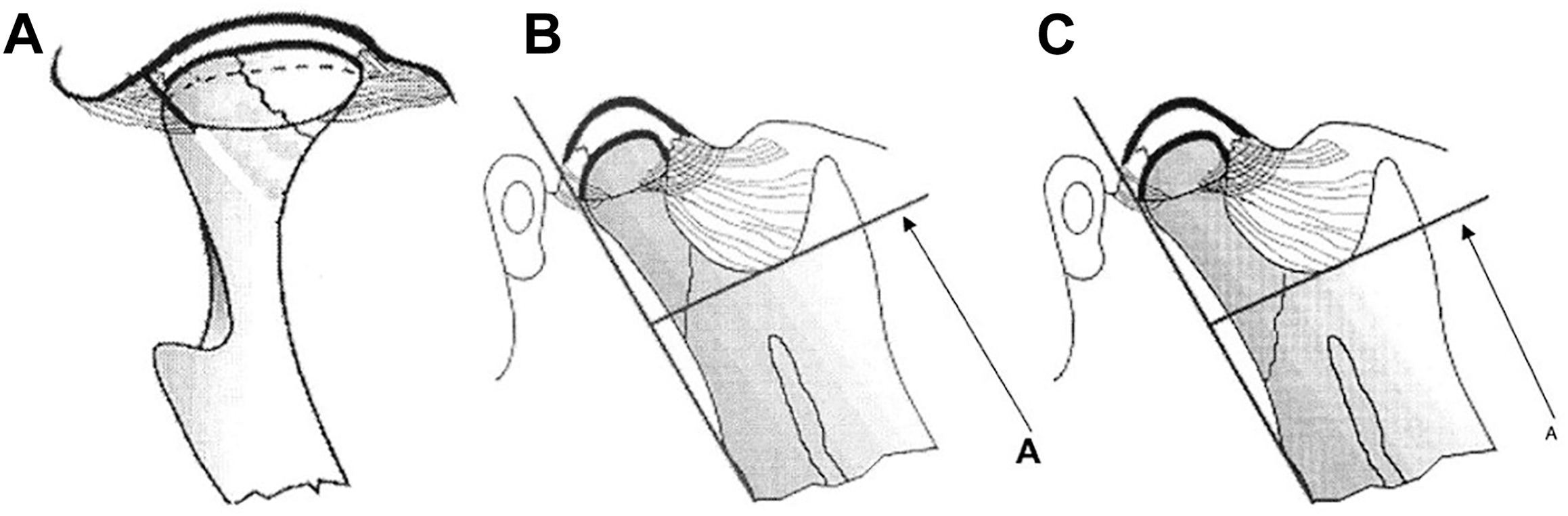 An illustration shows three types of mandibular fractures including condylar head, condylar neck, and condylar base fractures.