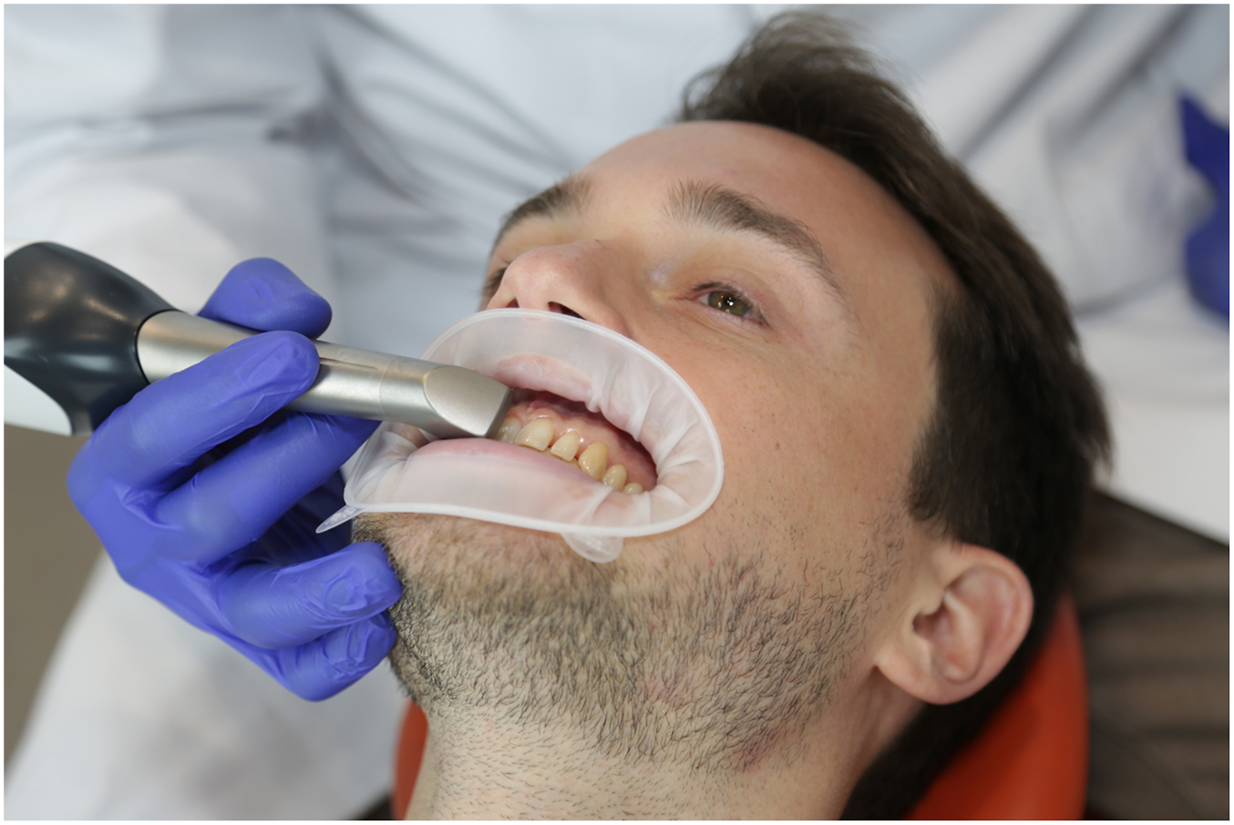 A photograph shows a dentist using a handheld intraoral scanner to capture 3 D images of a patient's upper teeth while a cheek retractor holds the mouth open.