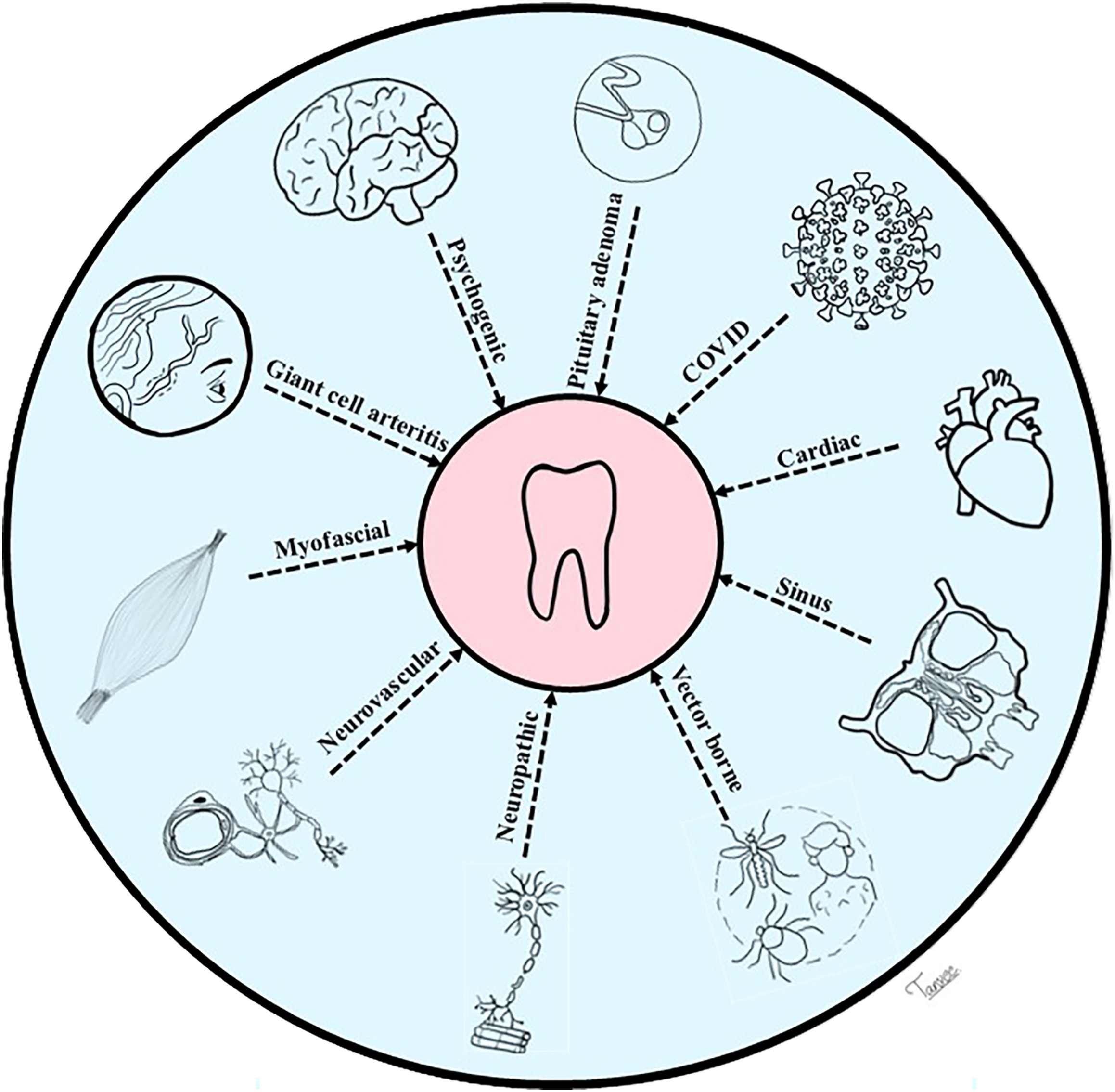 A diagram with a central tooth surrounded by eight circular icons representing different causes of nonodontogenic toothache.