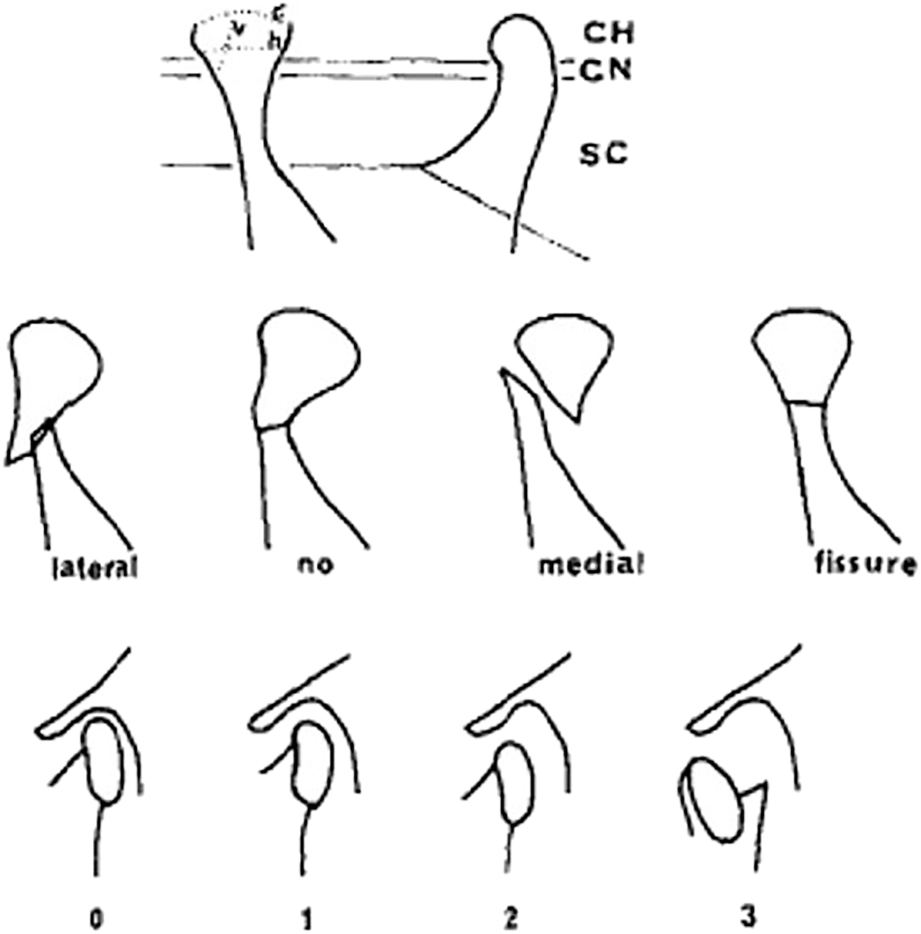 A schematic diagram shows the classification of condylar fractures based on fracture level, dislocation, and the relationship of the condylar head to the articular fossa.