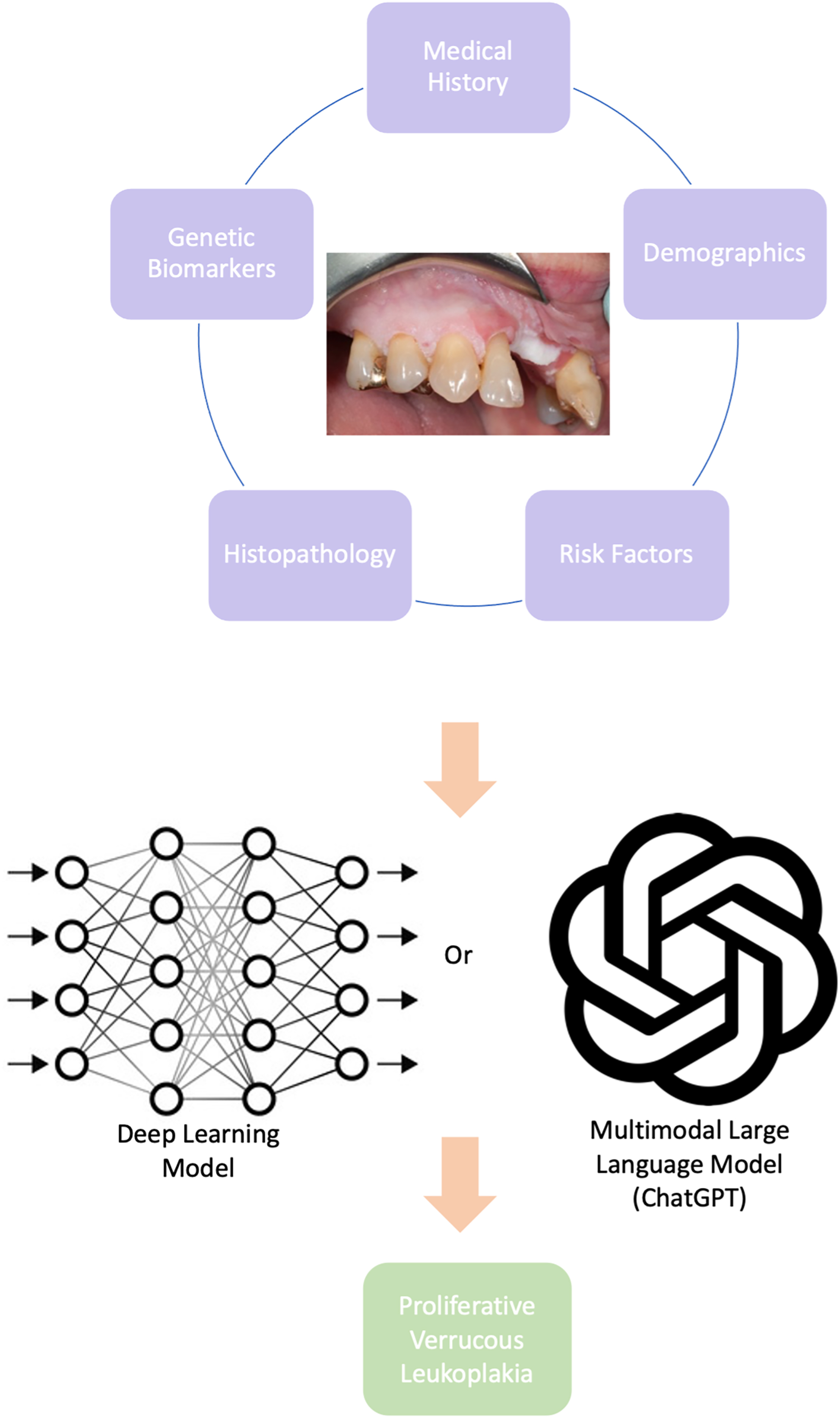 An illustration shows how different patient data can be analyzed using either a deep-learning model or a multimodal A I model to help identify proliferative verrucous leukoplakia.