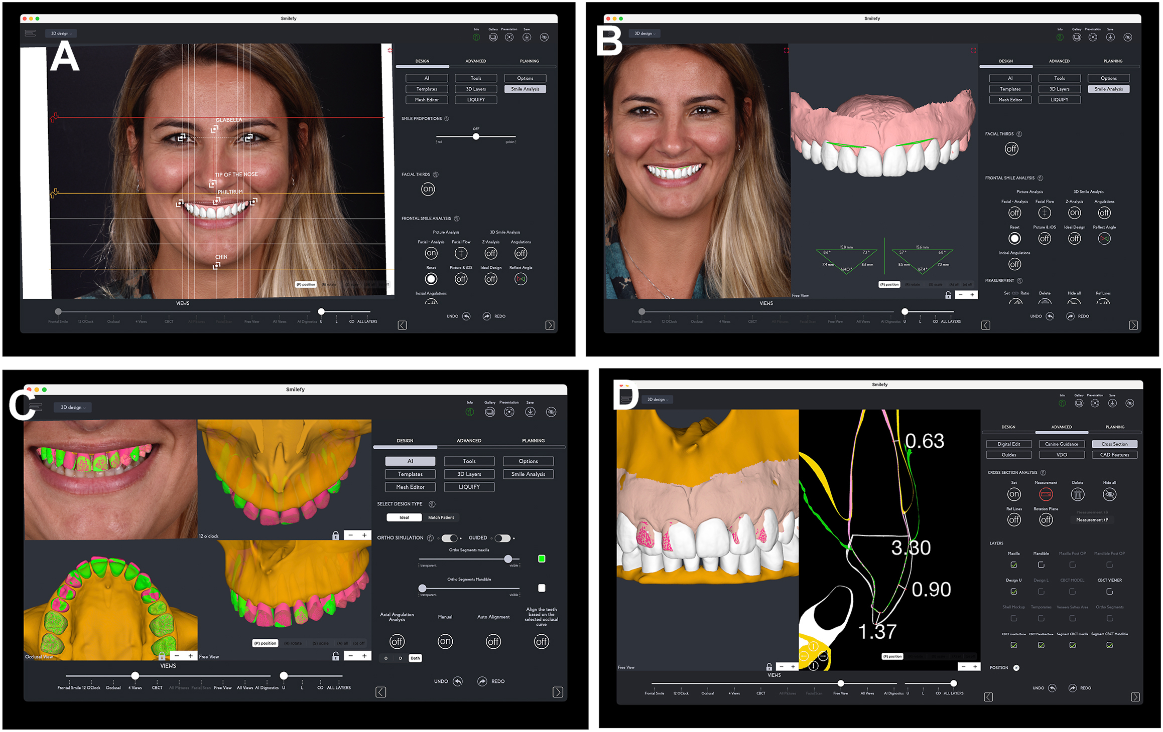 A set of four screenshots displays A I powered dental design software interfaces featuring 3 D teeth modeling facial analysis guides and automated aesthetic planning tools.