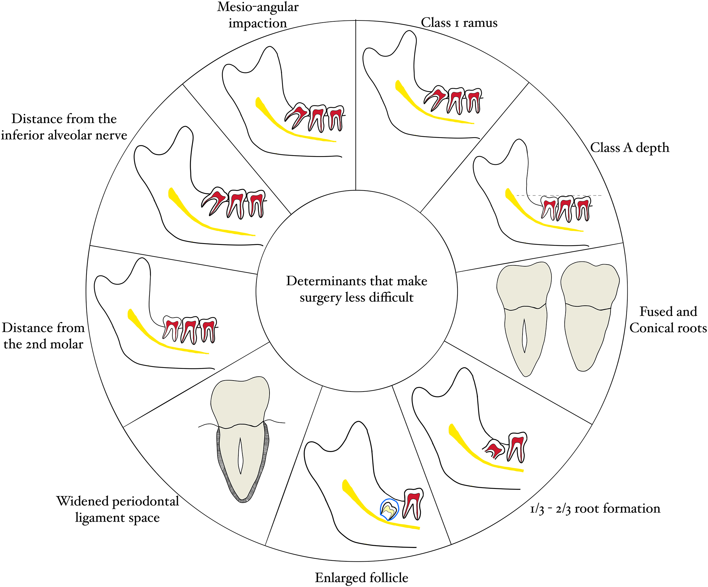 Circular diagram showing tooth shapes and positions that make surgery less difficult.