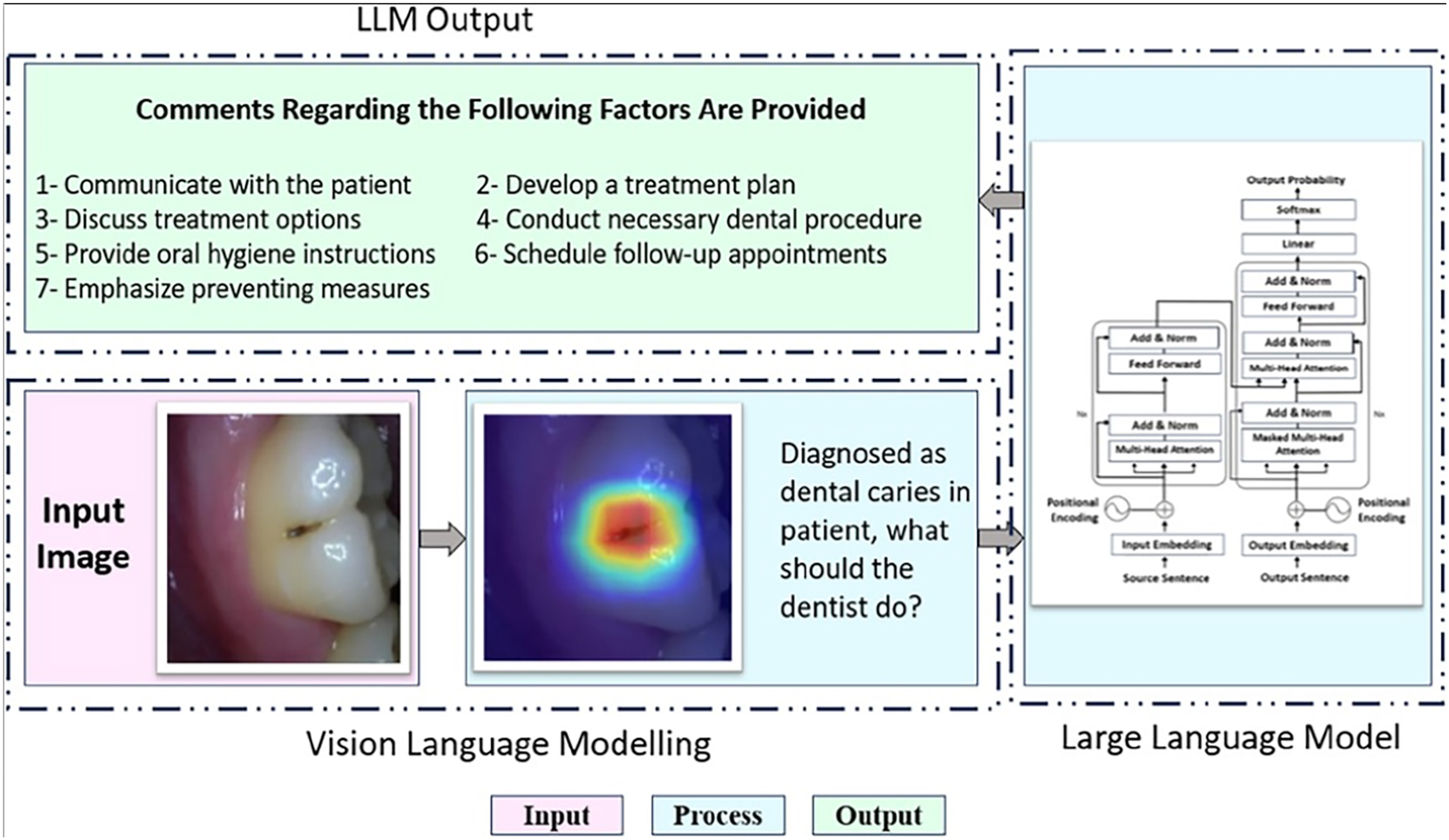 An illustration shows how a vision-language model and a large language model work together to help with a dental diagnosis.