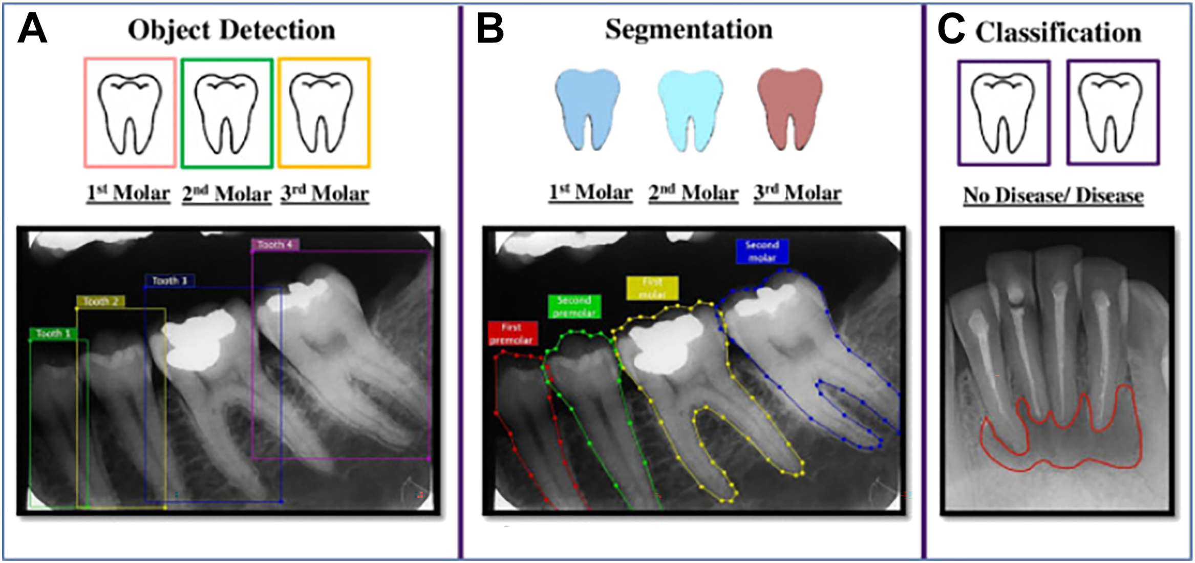 A diagram illustrates three dental A I tasks titled object detection, segmentation, and classification using tooth icons and X-rays with bounding boxes, contours, and disease labels.