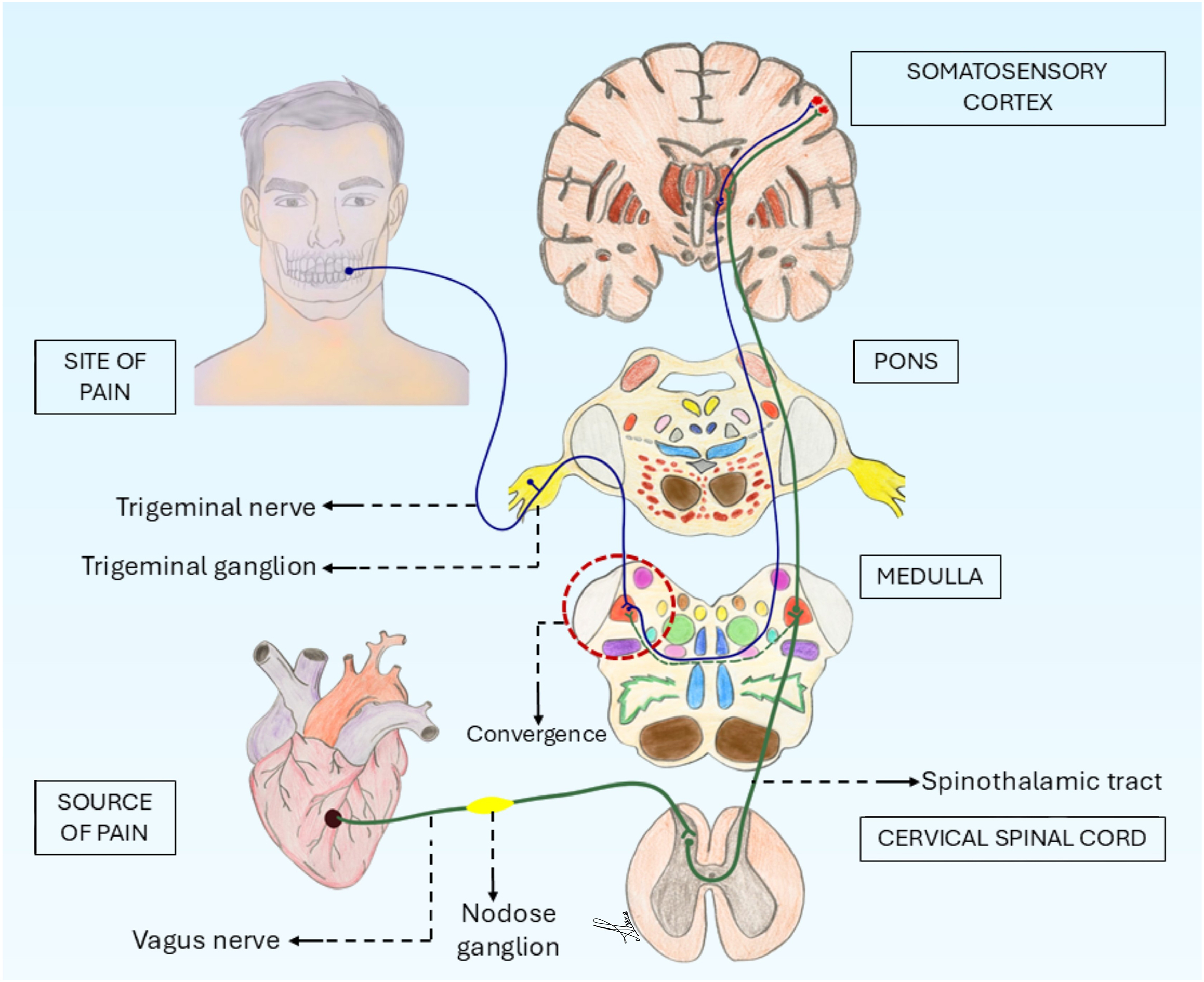A schematic representation connects the heart, spinal cord, brain, and face to indicate cardiac-related nonodontogenic toothache.